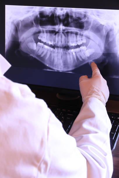 Best Dental Abscess Treatment in Cuba, MO